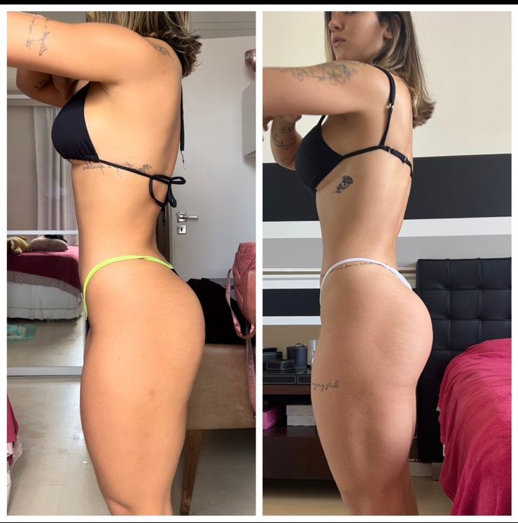 Antes e depois emagrecimento e definição abdominal Natflix 04