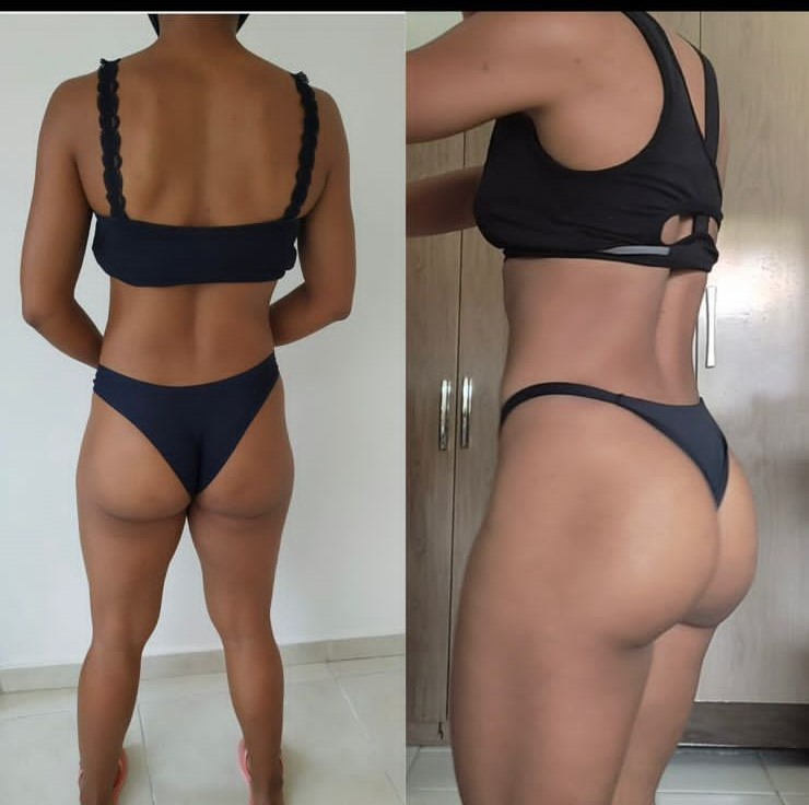 Antes e depois definição de abdômen e glúteos Natflix 07